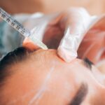 Botox injection into horizontal mimic wrinkles on the forehead