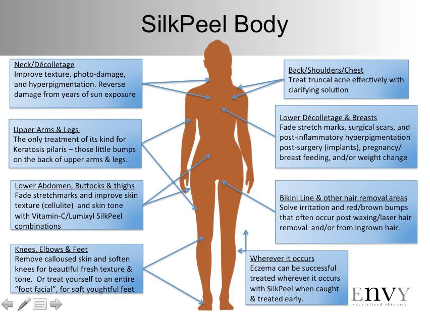 SilkPeel6 SilkPeel