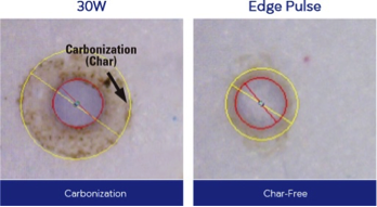 Edge Pulse Laser Technology: Char-Free Tissue Ablation Comparison of 30W laser burn with carbonization vs. Edge Pulse char-free precision.
