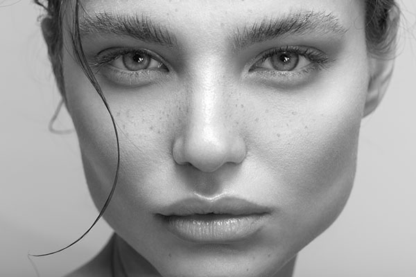 2 JUVEDERM LYFT